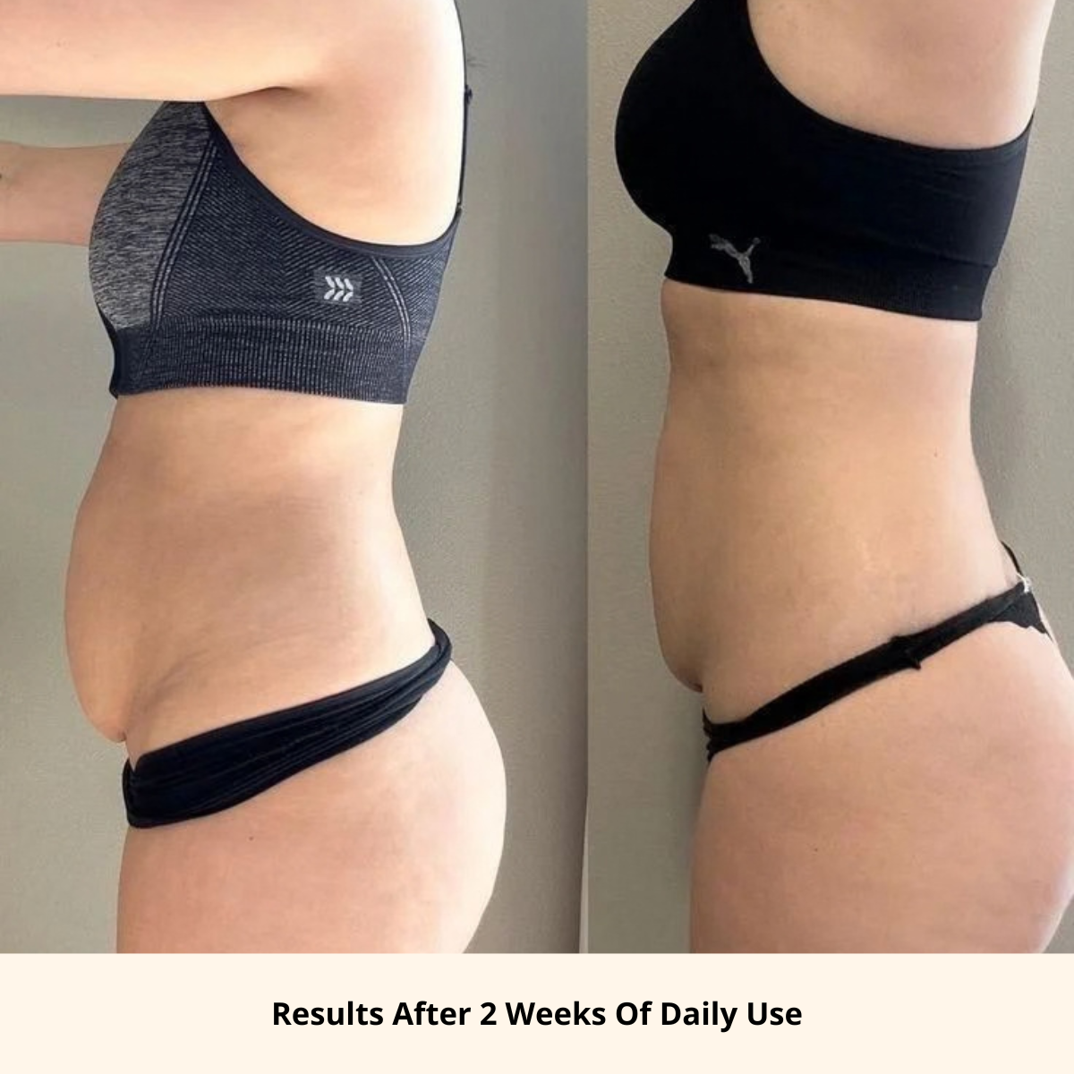 Anti-Cellulite Body Oil