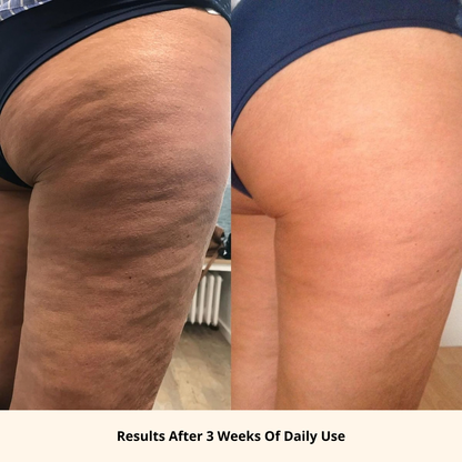 Anti-Cellulite Body Oil